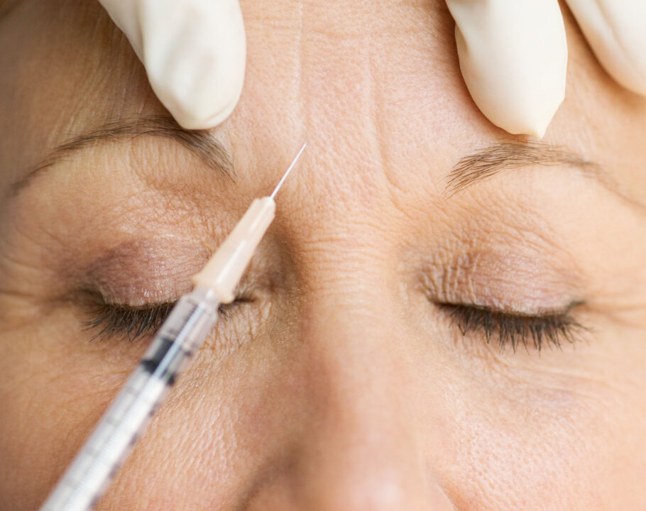 woman getting neurotoxin in forehead