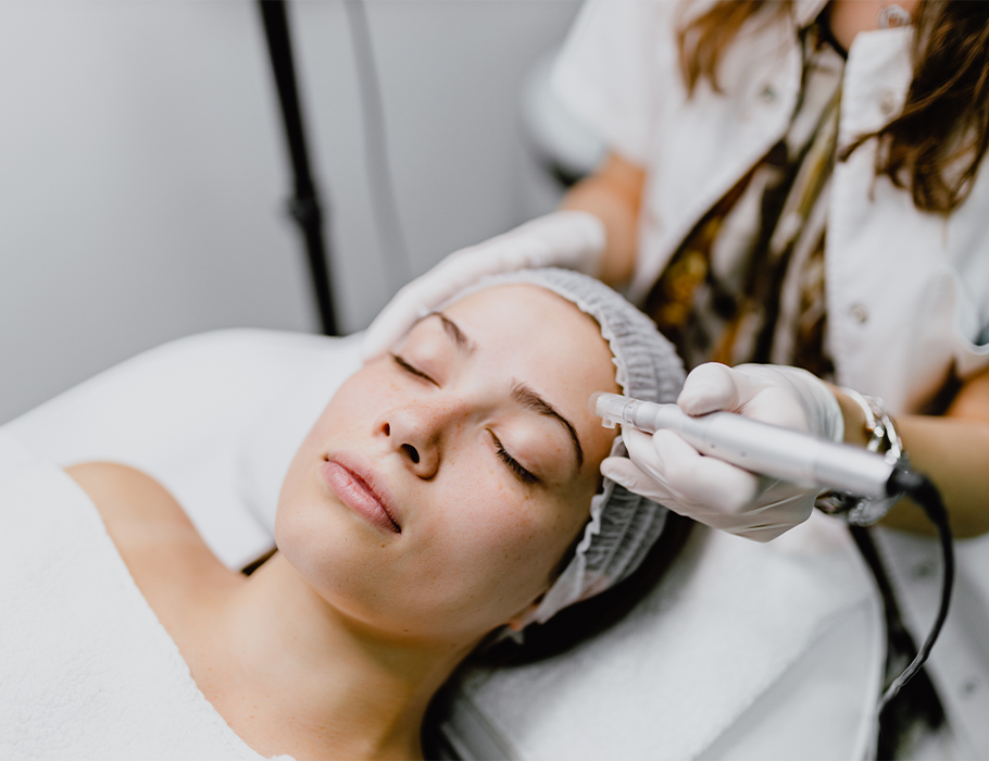 woman getting microneedling treatment on the face